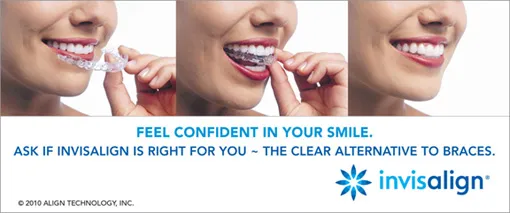 Invisalign clear aligners for discreet orthodontic treatment
