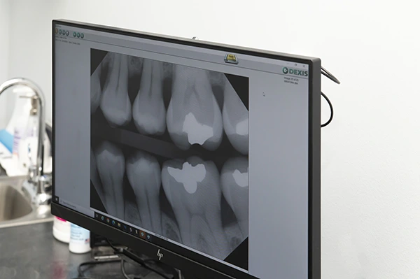 Dental imaging used during a TMJ evaluation