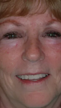 Smile after cosmetic dental treatment, gallery case 8