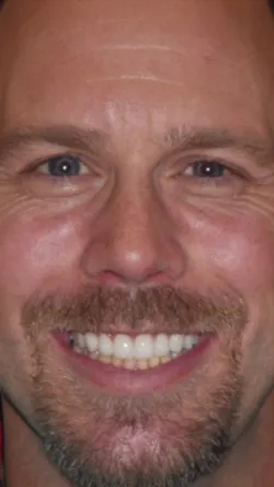 Smile after cosmetic dental treatment, gallery case 9