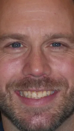 Smile before cosmetic dental treatment, gallery case 9