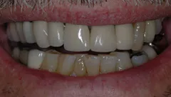 Smile before cosmetic dental treatment, gallery case 10 detail view