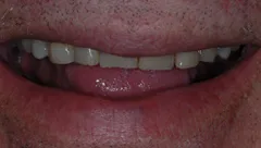 Smile before cosmetic dental treatment, gallery case 12 detail view