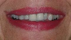 Smile before cosmetic dental treatment, gallery case 20 detail view