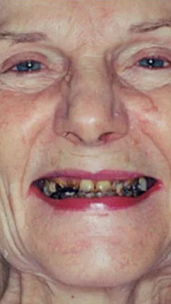 Smile before cosmetic dental treatment, gallery case 27
